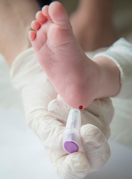 A baby's foot received the prick test