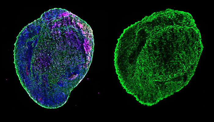 organoids