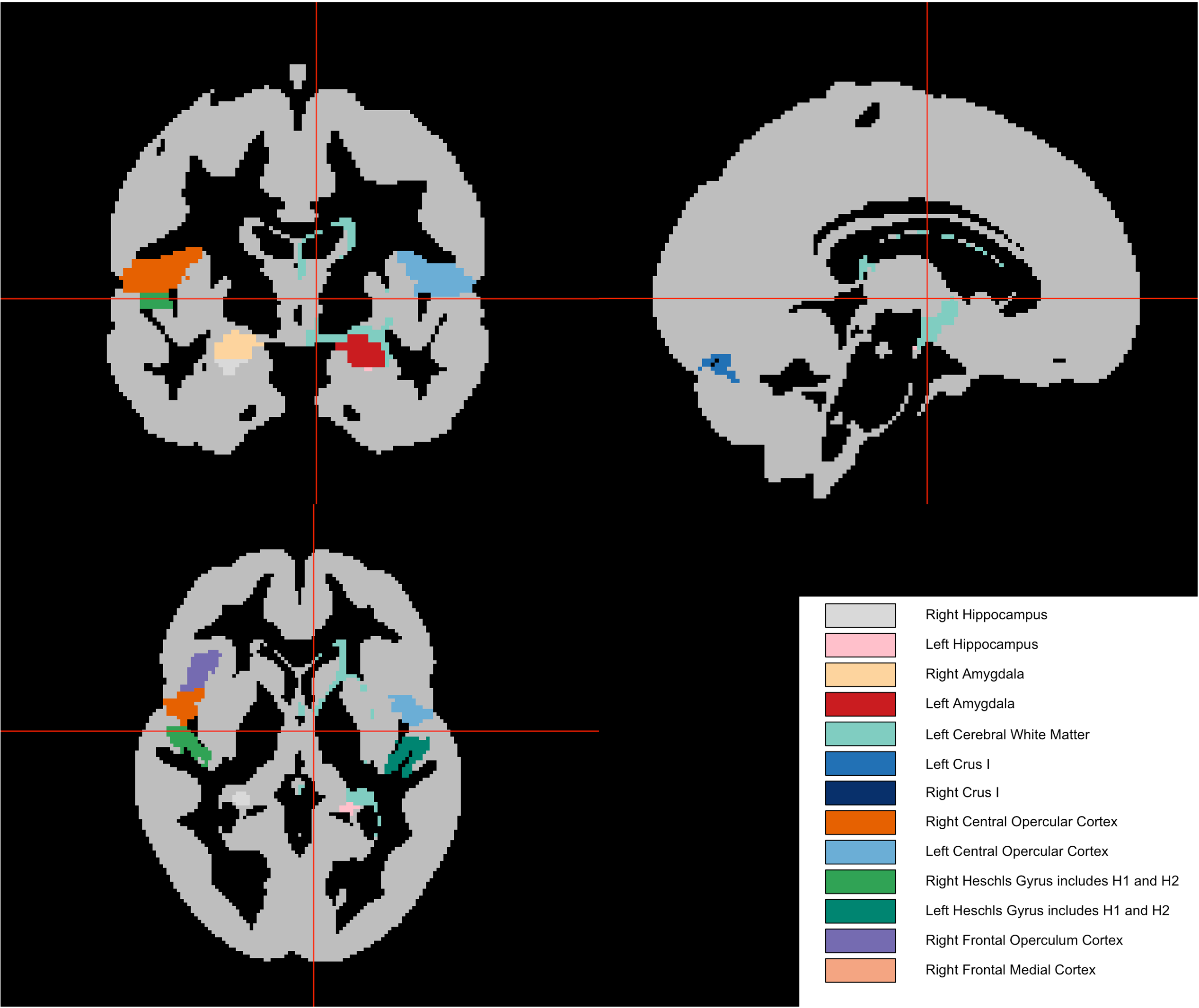 Image of brain scan showcasing brain regions