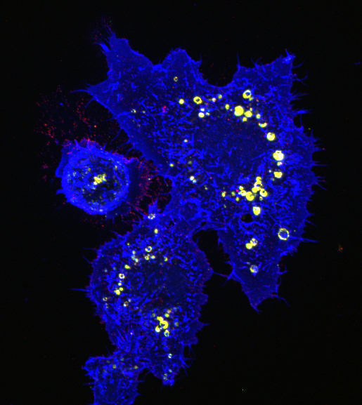 Fluorescence microscopy 