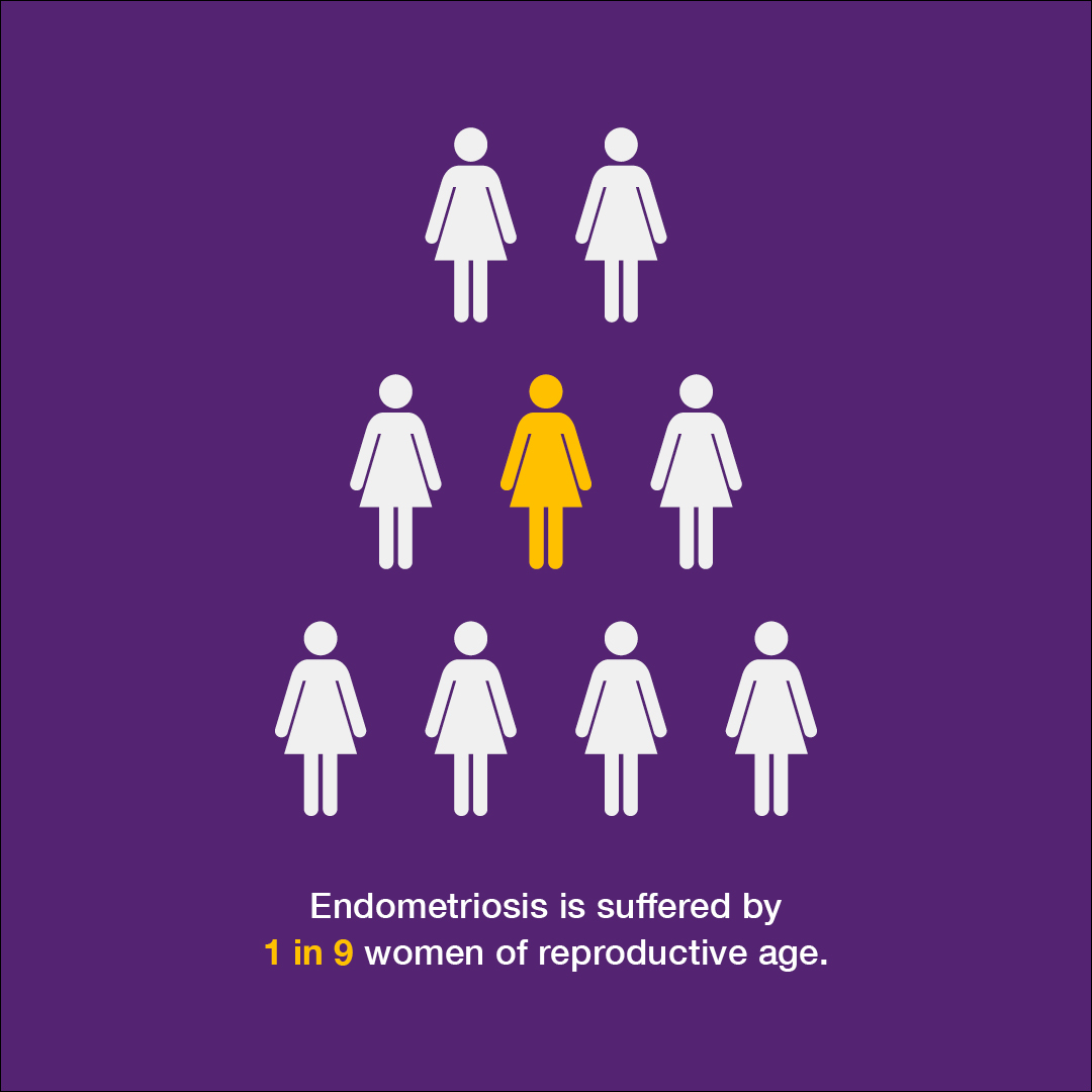 One in nine women of reproductive age have endometriosis