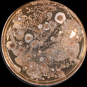 Bacteria and fungi grown from soil sample in petri dish
