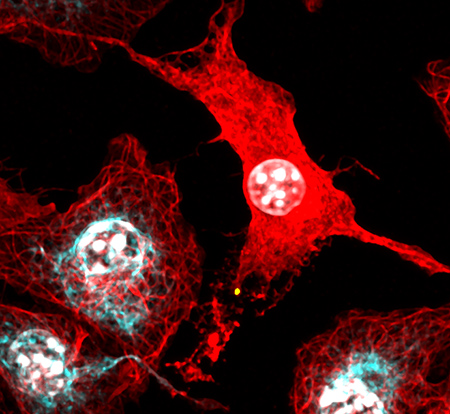 Cells undergoing programmed cell death