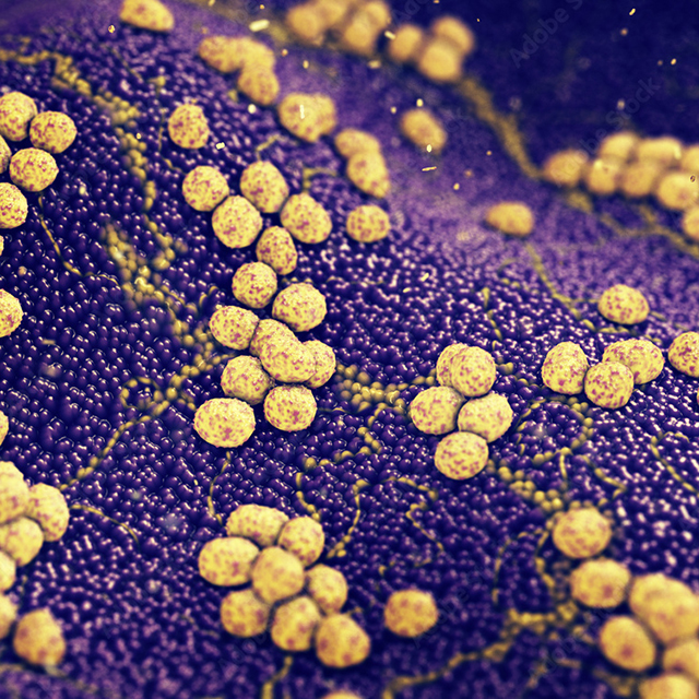 Staphylococcus aureus