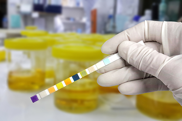 Measuring pH of urine samples