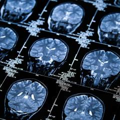 Brain scans