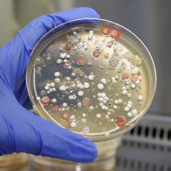 A hand with blue gloves holding a petri dish with bacteria and fungi grown from a soil sample