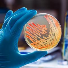 Researcher holds up agar plate showing bacterial colonies