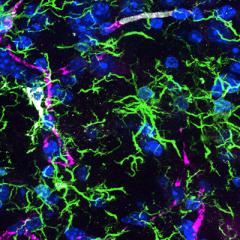 Image of neurons on a black background