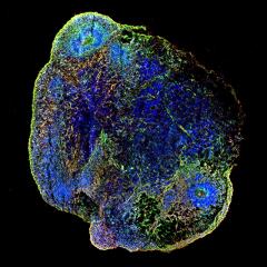 An image of an organoid - a model that can be used to test new therapeutics for seizures