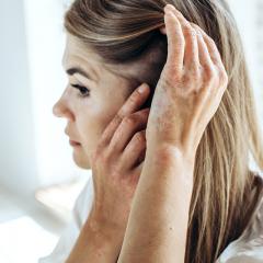 A woman inspects her skin for psoriasis