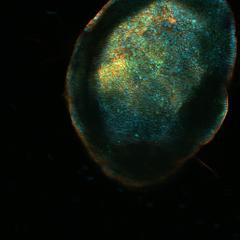 An endometrial ‘organoid’ grown from adult stem cells