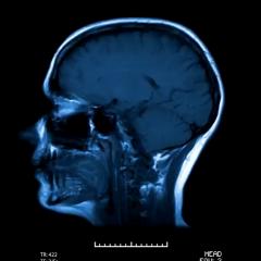 Brain