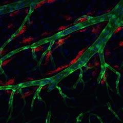 Lymphatic brain cell image