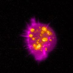 A cancer cell imaged in the new facility