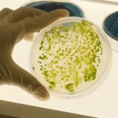 Photosynthetic micro algae from the Hankamer group.