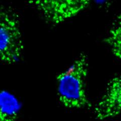 Researchers have discovered how bacteria combat the body's zinc response.
