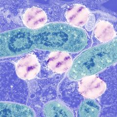 Electron micrograph of macrophage with green bacteria surrounded by pink  lipid droplets