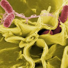 A healthy gut may reduce the longevity of people living with motor neurone disease (MND).