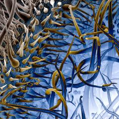 An Australian stinging tree that causes extreme pain to its victims has been transformed into an award-winning artwork for this year’s IMB Jo Underhill Art Award.