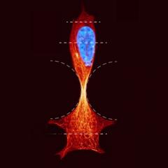 Microscope image of cell migrating through tissue