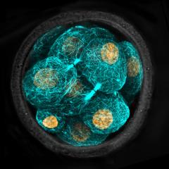 Visualisation of the internal cytoskeleton of the cells of the early mammalian embryo. Image courtesy of the lab of Dr Nicolas Plachta, Institute of Molecular and Cell Biology (IMCB), A*STAR.