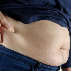 A gene that helps to control inflammation increases the risk of obesity.