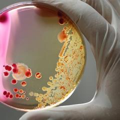 Gloved hand holding bacterial plate 